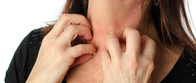 comment savoir si on est allergique au gluten
